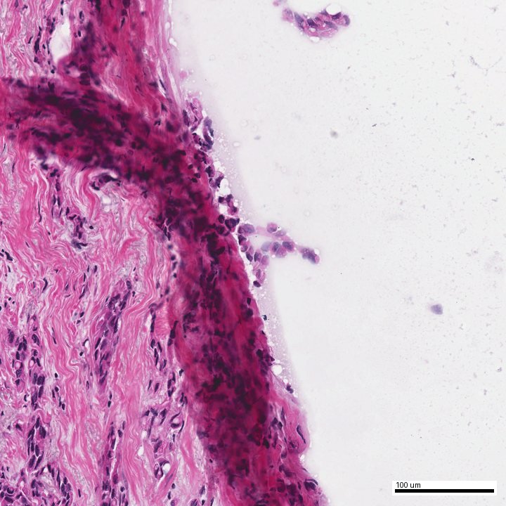 Illustrative H&E field used for lymphocyte analysis