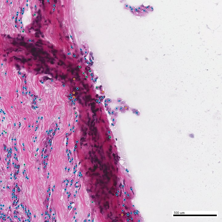 AI nuclei overlay on the same field