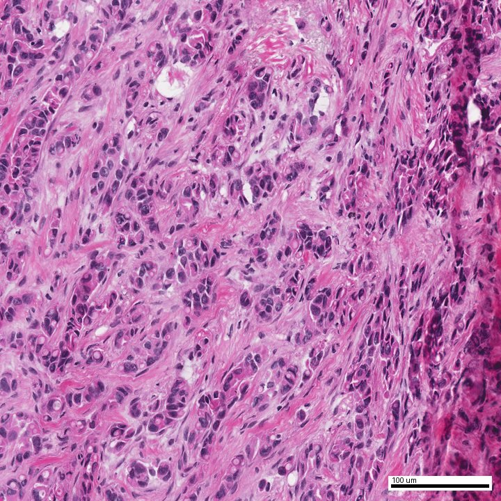 H&E tissue field from the de-identified demonstration report