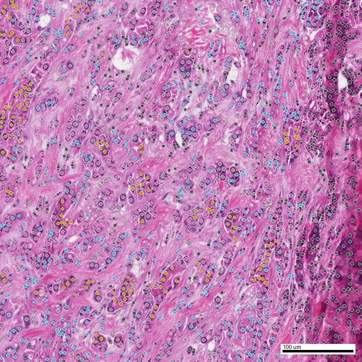 AI-predicted virtual phenotype map on the same tissue field